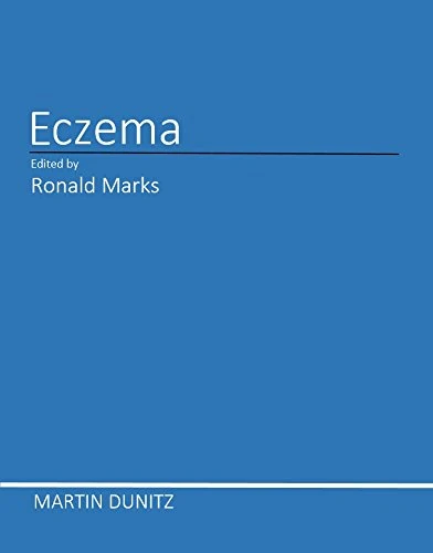 ECZEMA