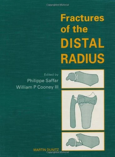 CRC Press - Fractures of the Distal Radius Medical Text