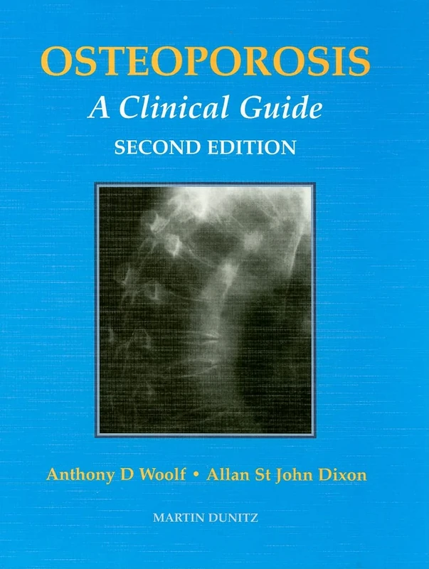 OSTEOPOROSIS: A Clinical Guide