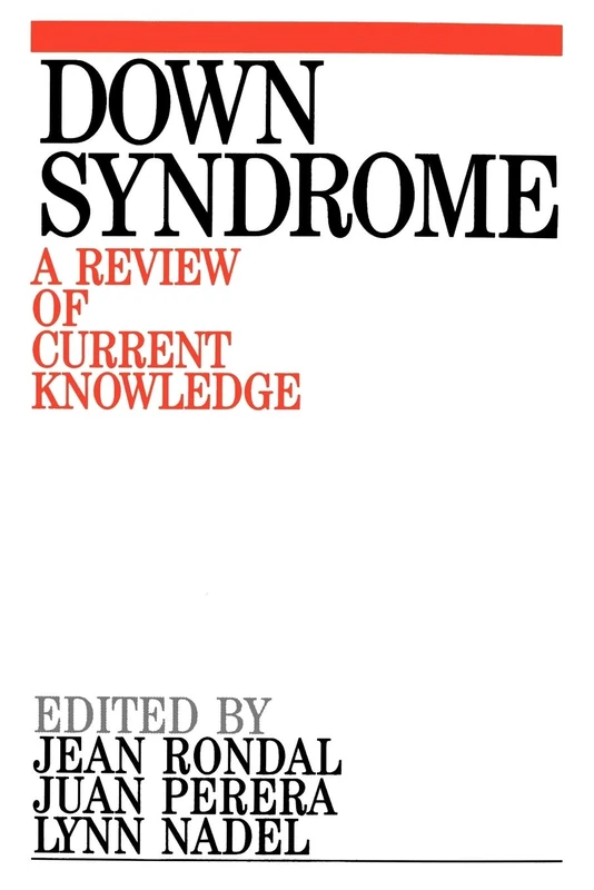 Down Syndrome: A Review of Current Knowlegde