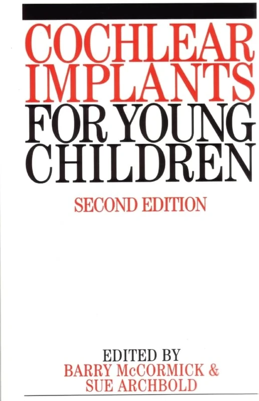 Cochlear Implants for Young Children: The Nottingham Approach to Assessment and Habilitation: 15 (Exc Business And Economy (Whurr))