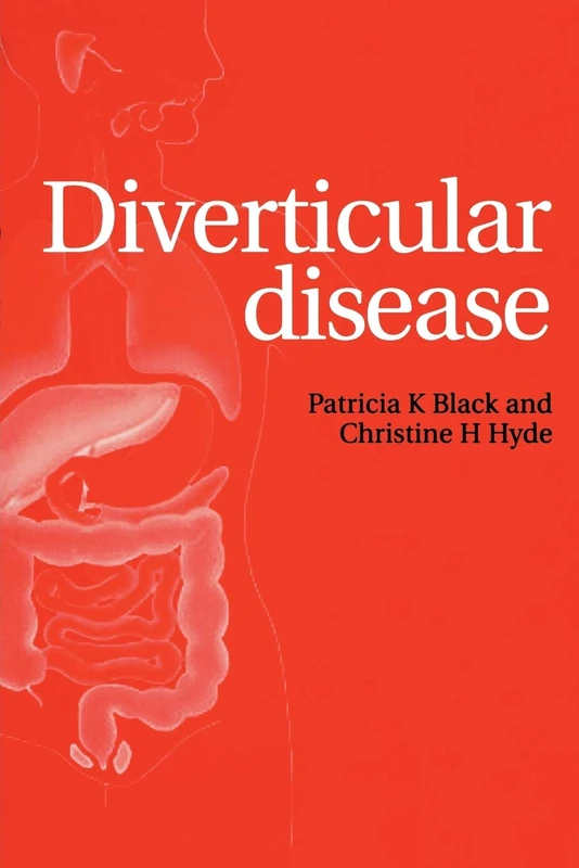 Diverticular Disease