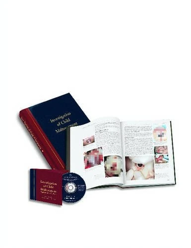 Investigation of Child Maltreatment with CDROM
