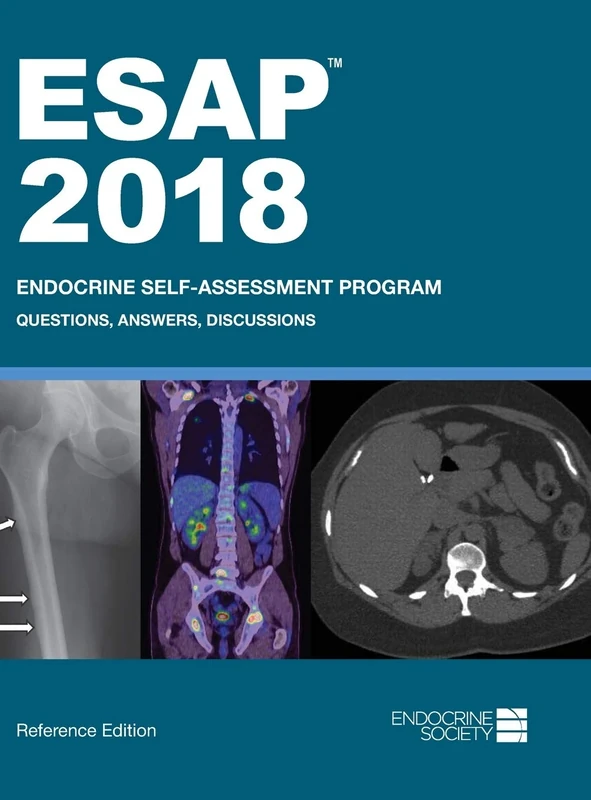 ESAP 2018: Endocrine Self-Assessment Program: Questions, Answers, Discussions, Reference Edition: 55