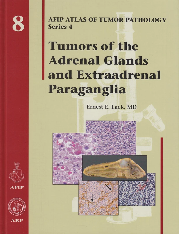Tumors of the Adrenal Glands and Extraadrenal Paraganglia: No. 8 (AFIP Atlas of Tumor Pathology, Series 4,)
