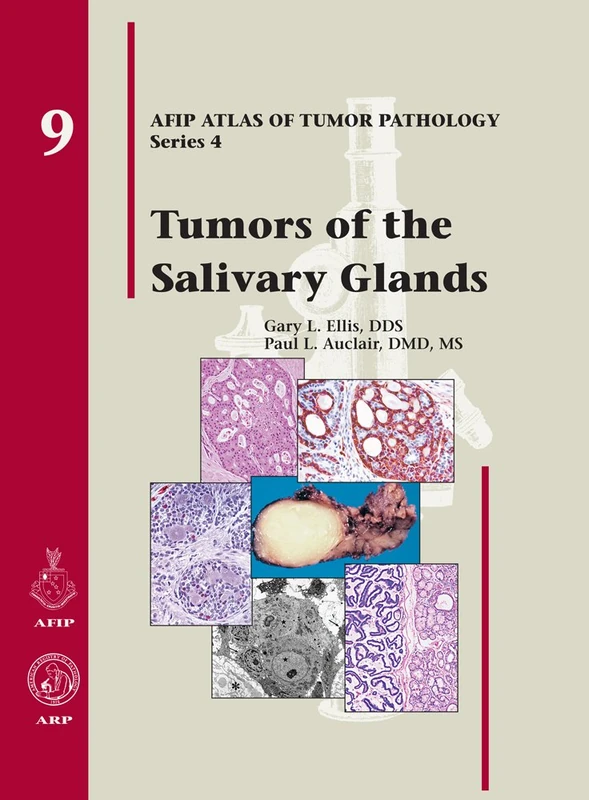 Tumors of the Salivary Glands: No. 9 AFIP Atlas of Tumor Pathology