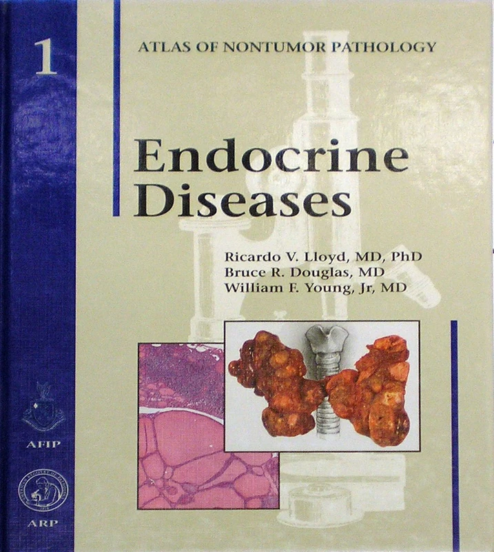 Endocrine Diseases: No 1 (Atlas of Non-Tumor Pathology, Series 1,)