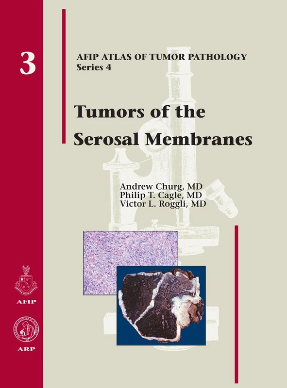 Tumors of the Serosal Membranes: No. 3 (AFIP Atlas of Tumor Pathology, Series 4,)