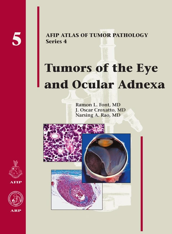 Amer Registry of Pathology - Tumors of the Eye and Ocular Adnexa