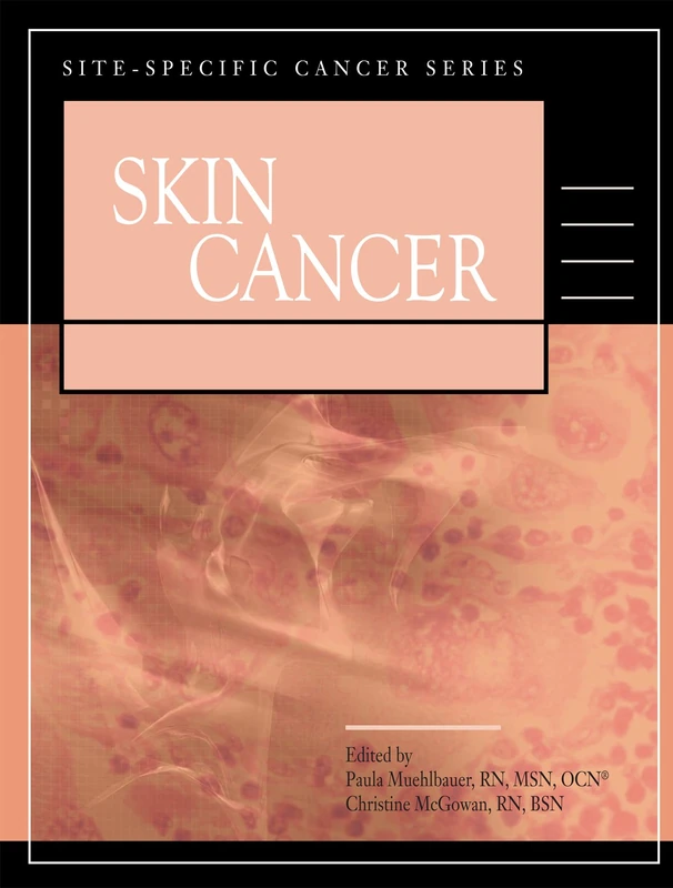 Skin Cancer (Site-specific Cancer Series)