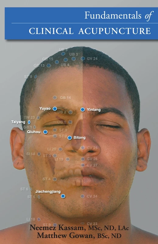 Fundamentals of Naturopathic Acupuncture