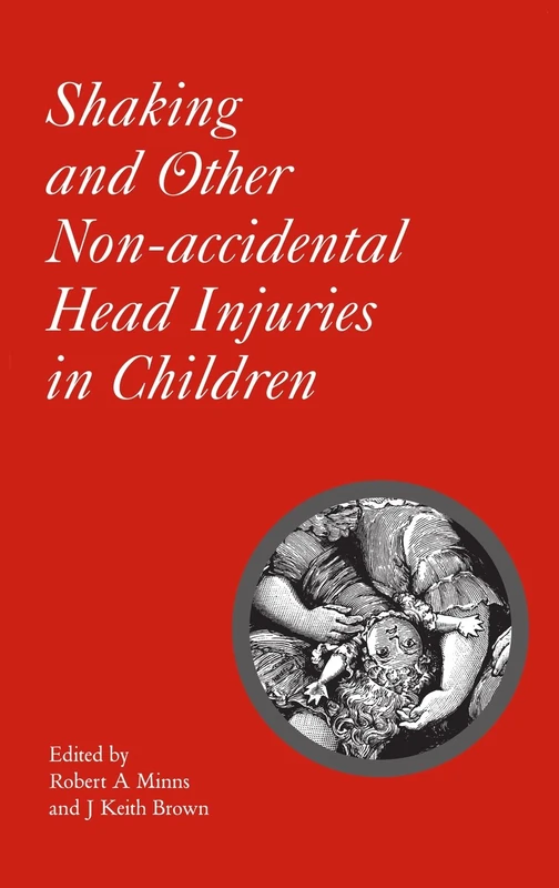 Shaking and Other Non-Accidental Head Injuries in Children: 162 (Clinics in Developmental Medicine (Mac Keith Press))