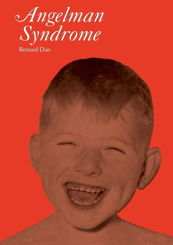 Angelman Syndrome (Clinics in Developmental Medicine): 177