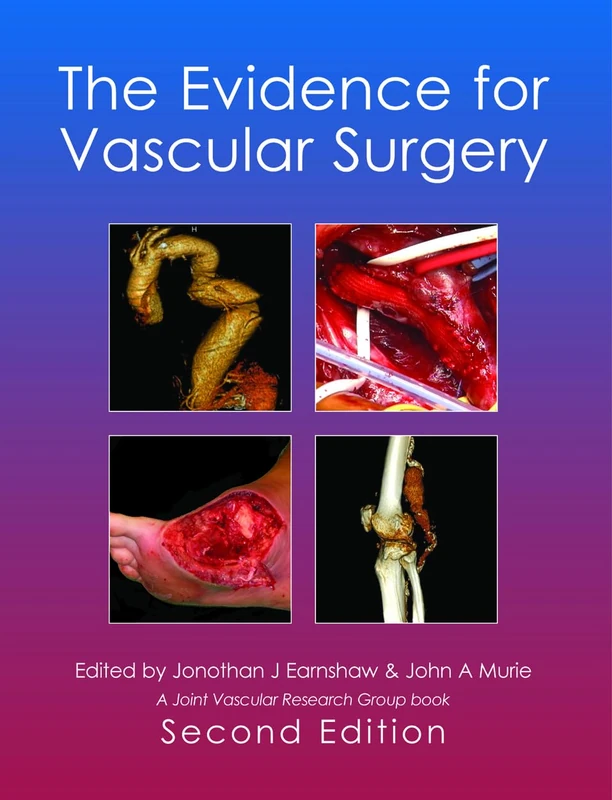 The Evidence for Vascular Surgery: 2nd Edition