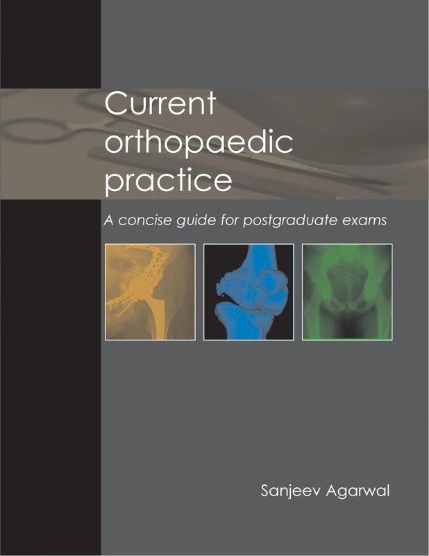 Current Orthopaedic Practice a Concise Guide for Postgraduate Exams