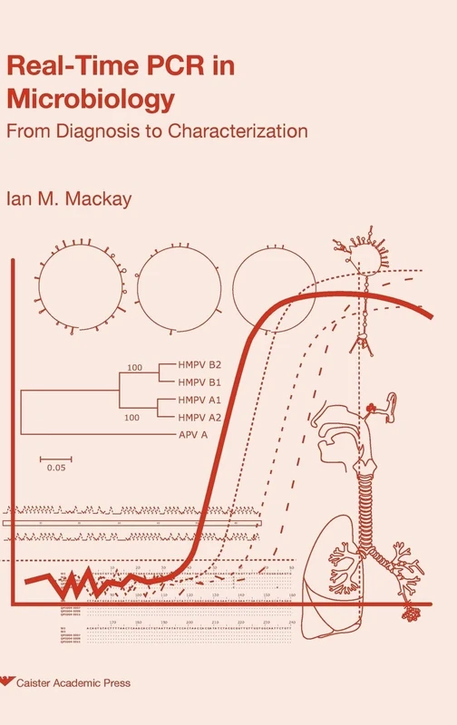 Real-time PCR in Microbiology: From Diagnosis to Characterization