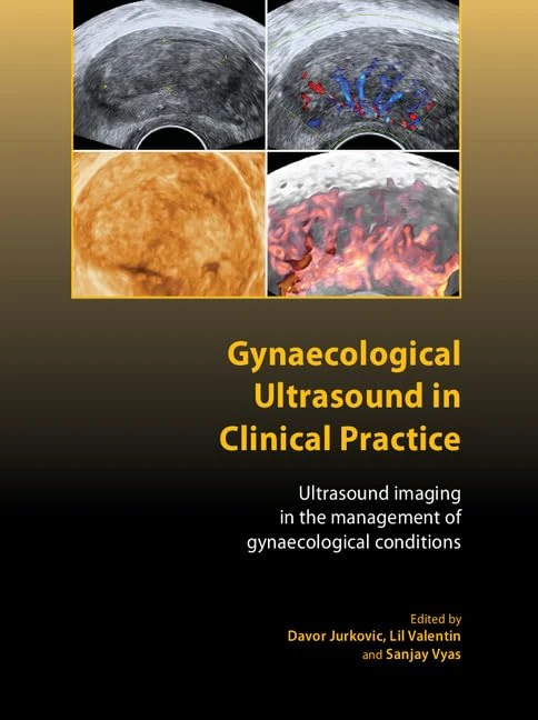 Gynaecological Ultrasound in Clinical Practice: Ultrasound Imaging in the Management of Gynaecological Conditions (Royal College of Obstetricians and Gynaecologists Advanced Skills)