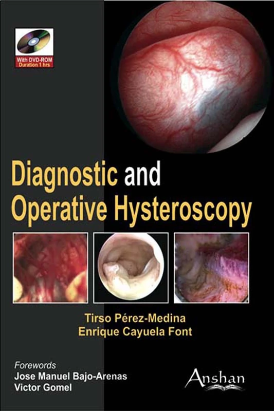 Diagnostic and Operative Hysteroscopy