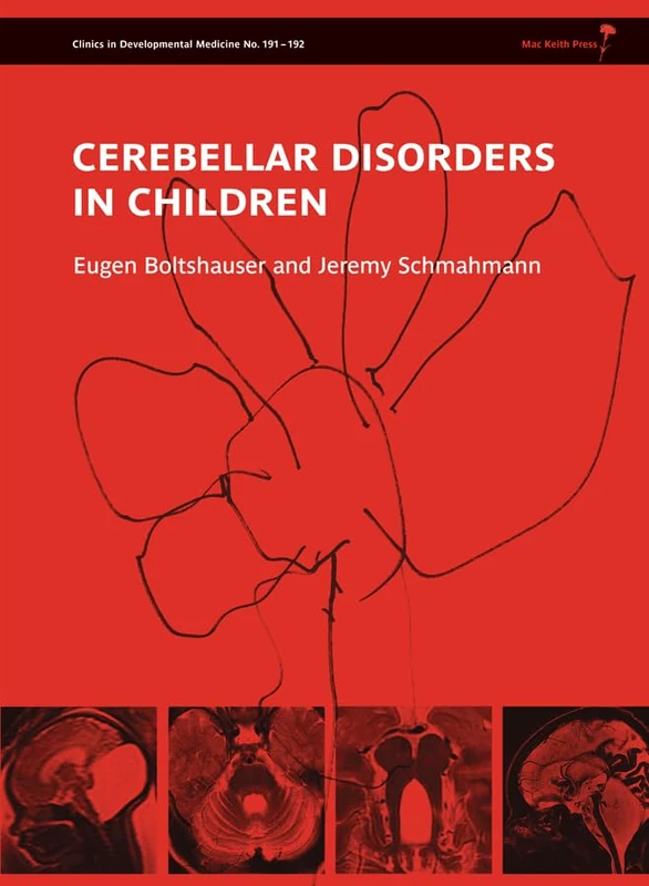 Cerebellar Disorders in Children: 191 (Clinics in Developmental Medicine)