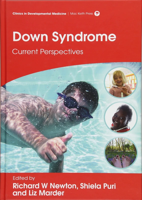 Down Syndrome: Current Perspectives (Clinics in Developmental Medicine)