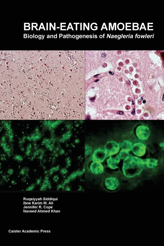 Brain-Eating Amoebae: Biology and Pathogenesis of Naegleria Fowleri - Image 1