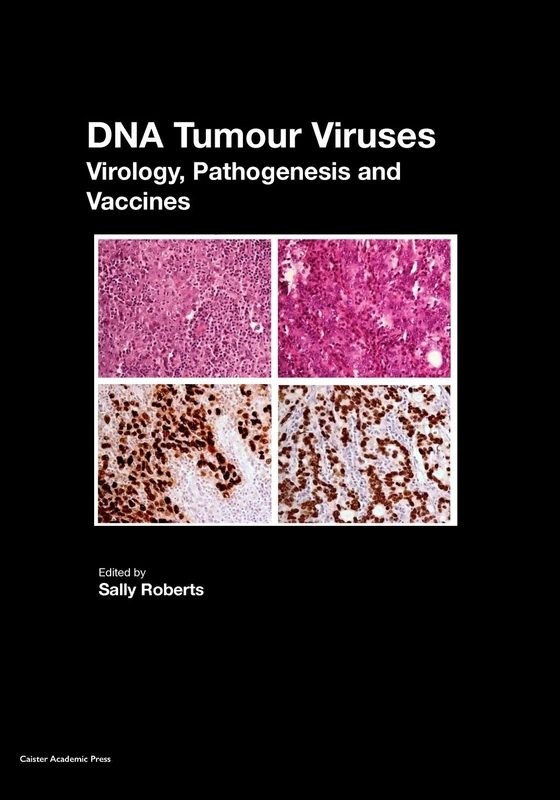 DNA Tumour Viruses - Caister Academic Press Virology Book