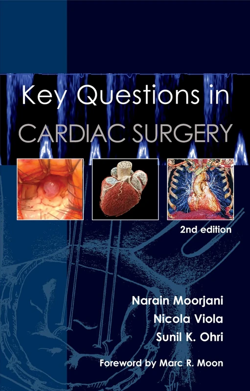 Key Questions in Cardiac Surgery, 2nd Edition: 4