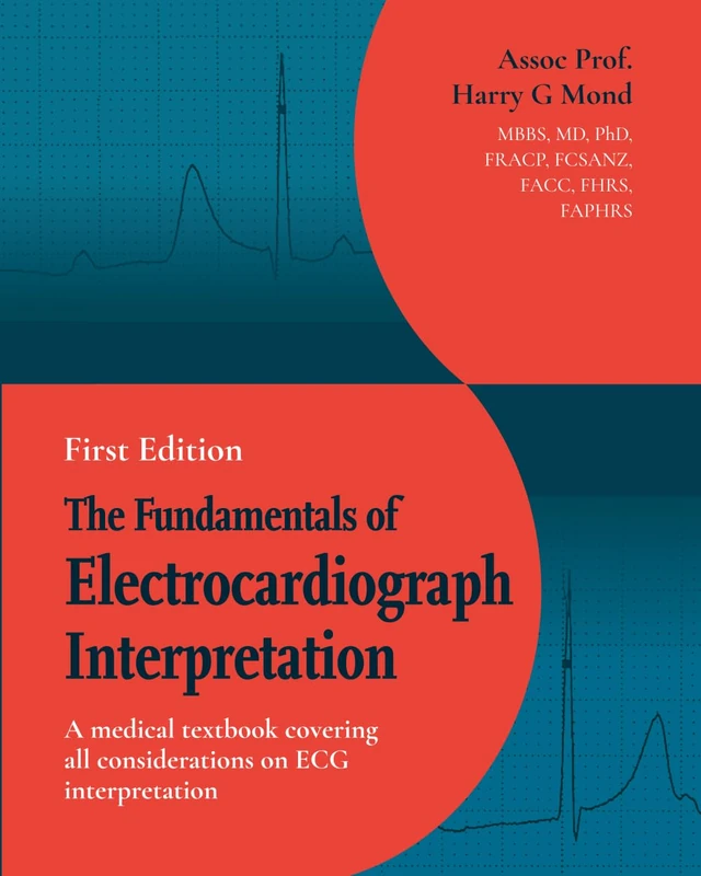 The Fundamentals of Electrocardiograph Interpretation: A medical textbook covering all considerations on ECG interpretation