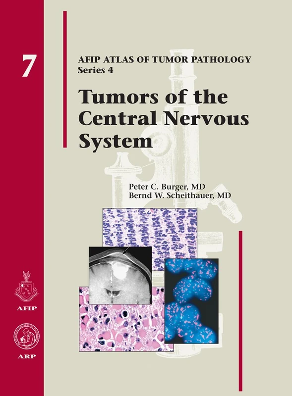 Tumors of the Central Nervous System: 7 - AFIP Atlas Series 4