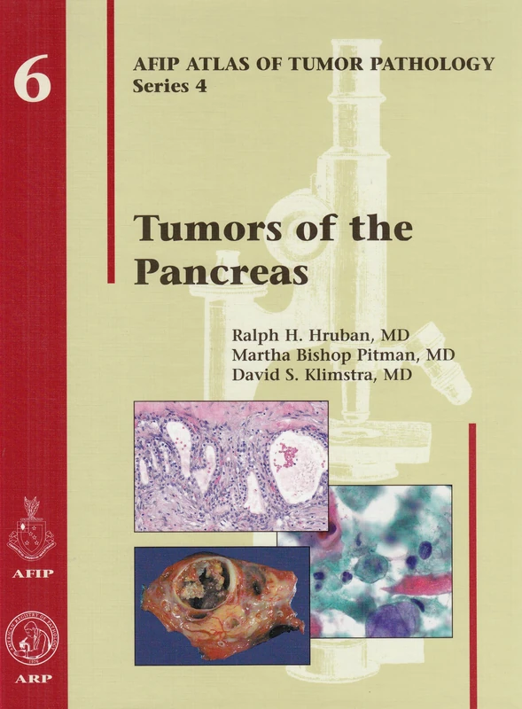 Tumors of the Pancreas: No. 6 (AFIP Atlas of Tumor Pathology, Series 4,)