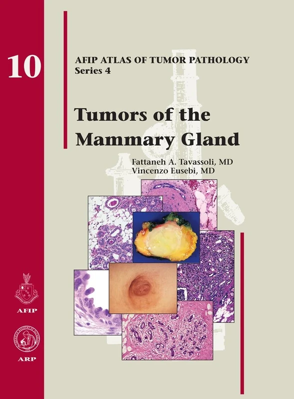 Tumors of the Mammary Gland: 10 (AFIP Atlas of Tumor Pathology, Series 4,)