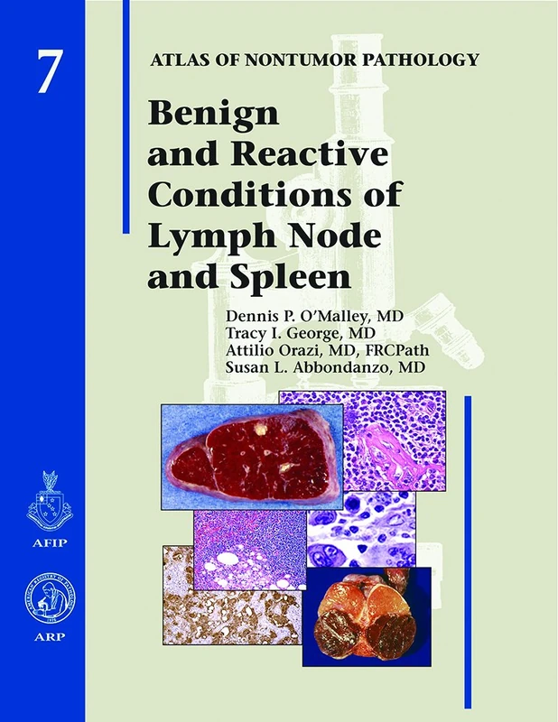 Benign and Reactive Conditions of Lymph Node and Spleen Atlas