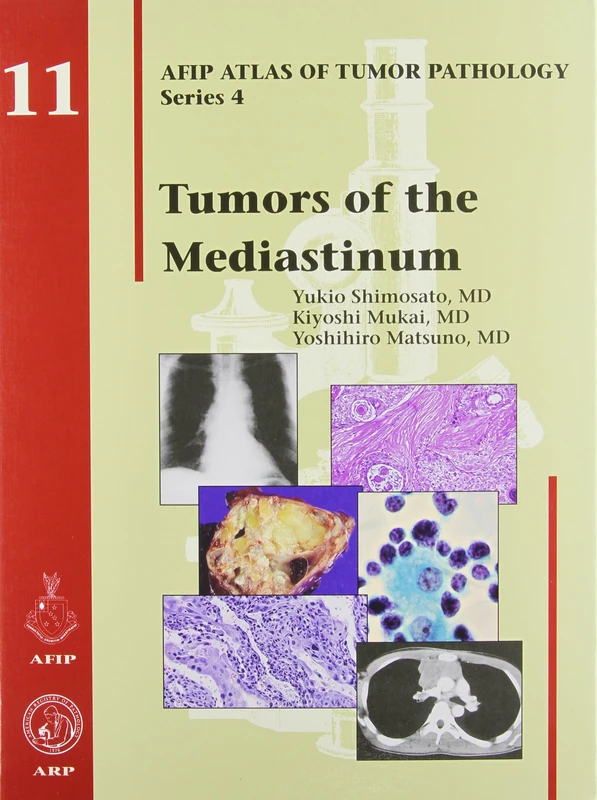 Tumors of the Mediastinum: No. 11 (AFIP Atlas of Tumor Pathology, Series 4,)