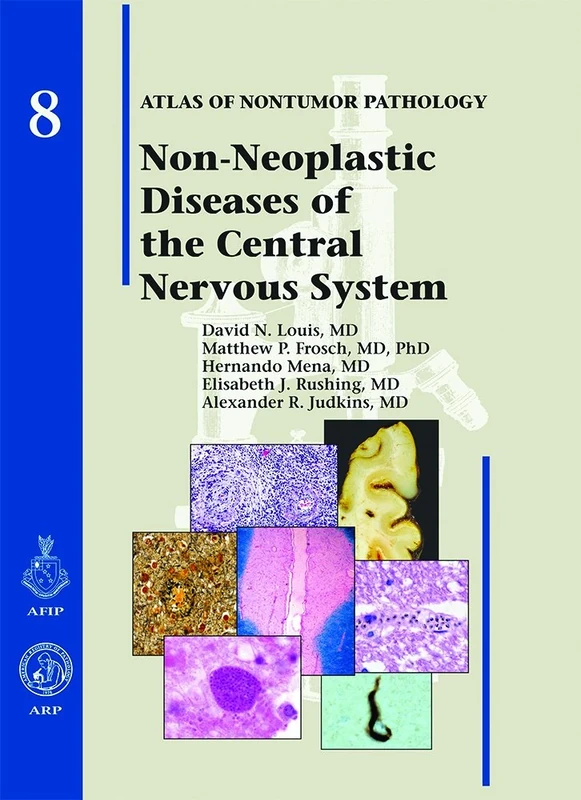Non-Neoplastic Diseases of the Central Nervous System: No 8 (Atlas of Non-Tumor Pathology, Series 1,)