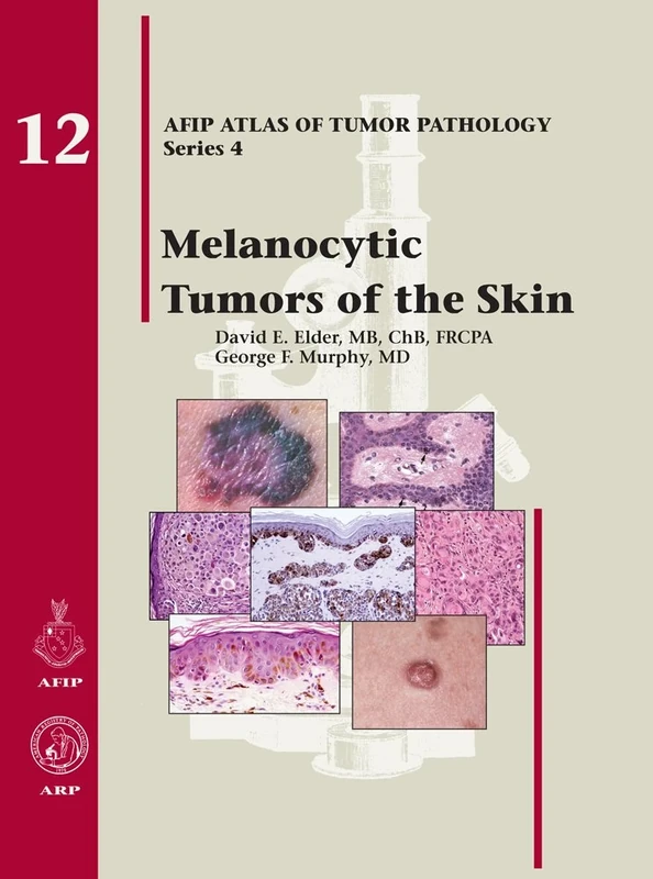 Melanocytic Tumors of the Skin (AFIP Atlas of Tumor Pathology, Series 4,)