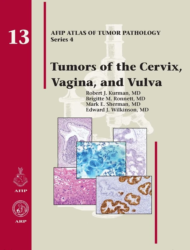 Tumors of the Cervix, Vagina, and Vulva: No. 13 (AFIP Atlas of Tumor Pathology, Series 4,)