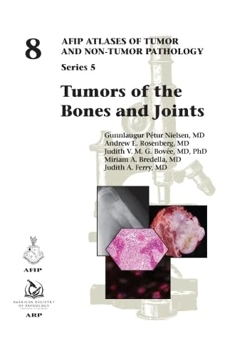 Tumors of the Bones and Joints: 8 (AFIP Atlases of Tumor and Non-tumor Pathology, Series 5)