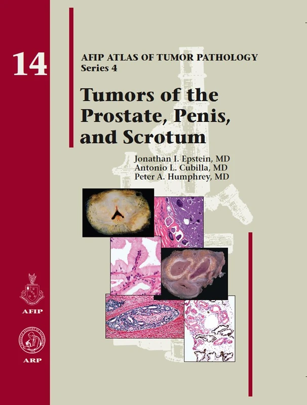 Tumors of the Prostate Gland, Seminal Vesicles, Penis, and Scrotum: No. 14 (AFIP Atlas of Tumor Pathology, Series 4,)