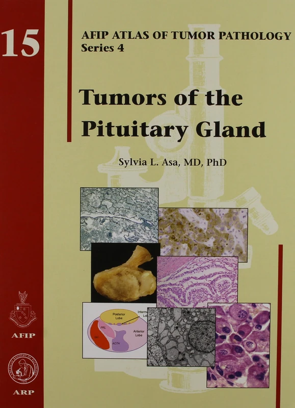 Tumors of the Pituitary Gland: AFIP Atlas of Tumor Pathology, Series 4: No. 15