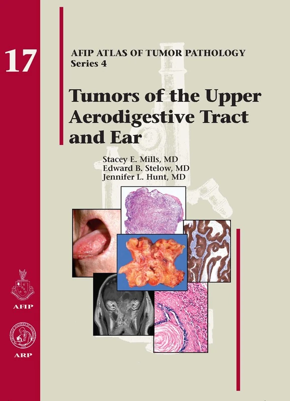 Tumors of the Upper Aerodigestive Tract and Ear: No.17 (AFIP Atlas of Tumor Pathology, Series 4,) - Image 1