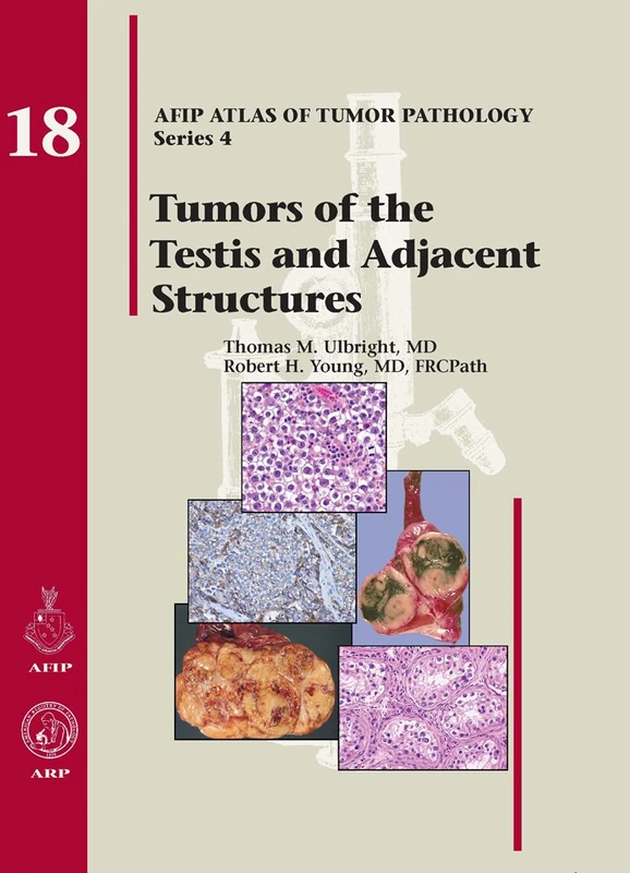 Tumors of the Testis and Adjacent Structures - AFIP Atlas No. 18