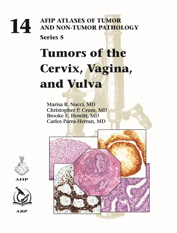 Tumors of the Cervix, Vagina, and Vulva: 14 (AFIP Atlas of Tumor and Non-Tumor Pathology, Series 5)