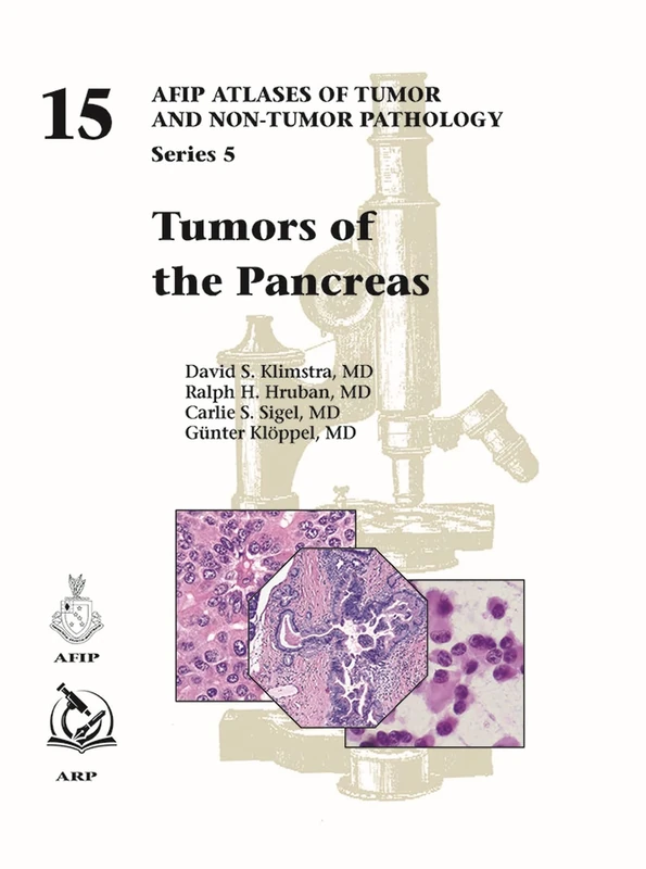 Tumors of the Pancreas: 15 (AFIP Atlas of Tumor and Non-Tumor Pathology, Series 5)