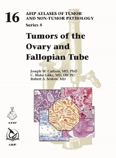 Tumors of the Ovary and Fallopian Tube (AFIP Atlas of Tumor and Non-Tumor Pathology, Series 5, 16)
