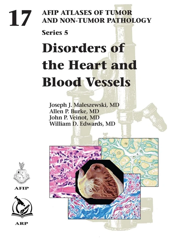 Disorders of the Heart and Blood Vessels: 17 (AFIP Atlas of Tumor and Non-Tumor Pathology, Series 5)