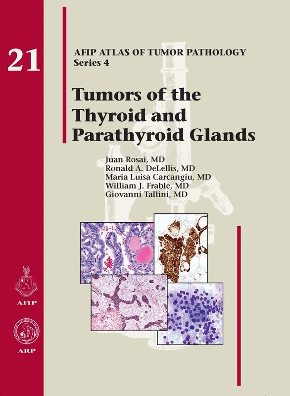 Tumors of the Thyroid and Parathyroid Glands (Atlas of Tumor Pathology, Series 4): No. 21 (AFIP Atlas of Tumor Pathology, Series 4,)