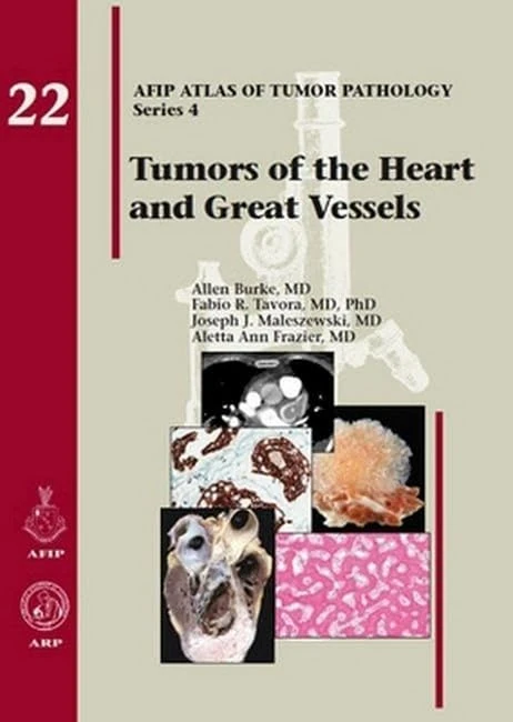 Tumors of the Heart and Great Vessels: No. 22 (AFIP Atlas of Tumor Pathology, Series 4,)