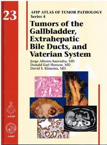 Tumors of the Gallbladder, Extrahepatic Bile Ducts, and Vaterian System: No. 23 (AFIP Atlas of Tumor Pathology, Series 4,)