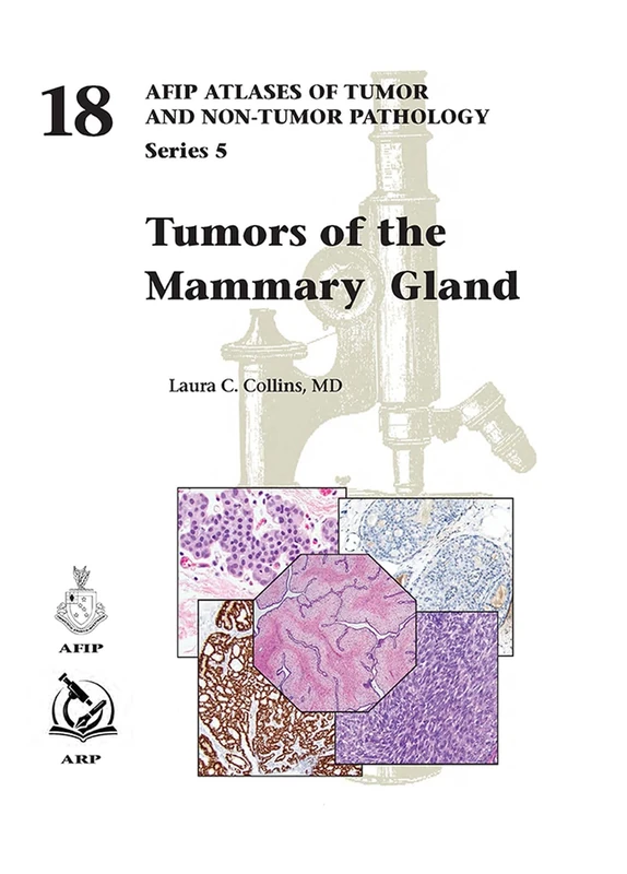 Tumors of the Mammary Gland (AFIP Atlas of Tumor and Non-Tumor Pathology, Series 5)