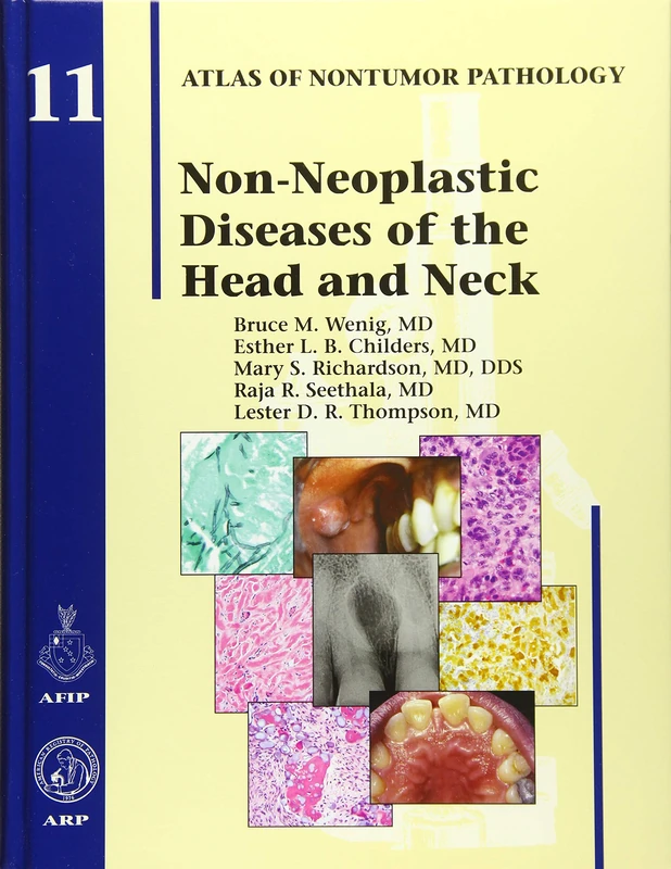 Non-Neoplastic Diseases of the Head and Neck (Atlas of Non-Tumor Pathology, Series 1, Number 11)